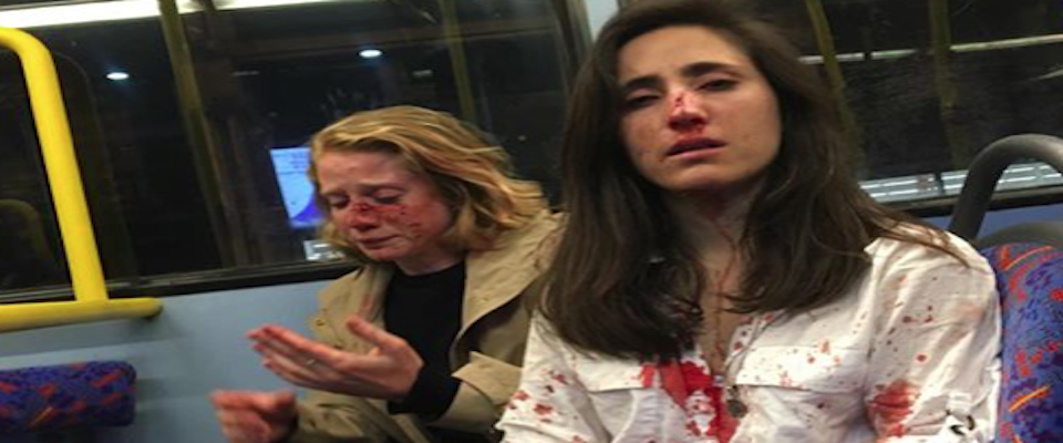 Picchiate sul bus a Londra perché lesbiche: la foto delle due donne insanguinate fa il giro del web