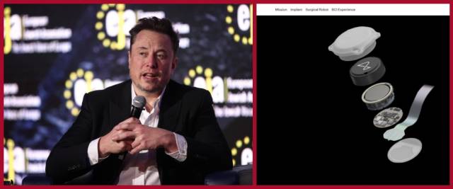 Musk chip nel cervello